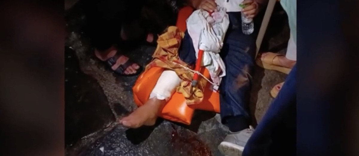 «Με ένα φανελάκι προσπαθήσαμε να σταματήσουμε την αιμοραγία» (βίντεο) – ONLARISSA.GR Νέα Ειδήσεις Λάρισα