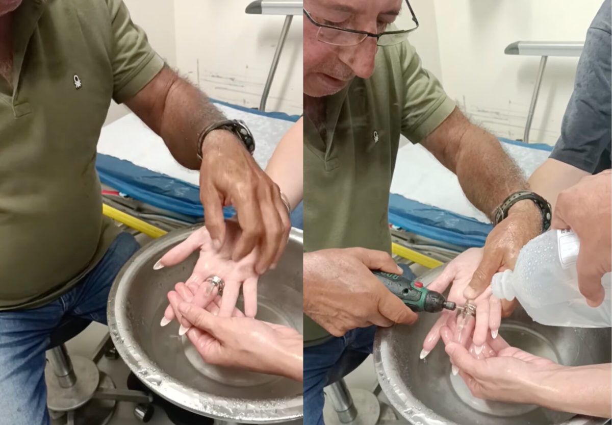 Επιχείρηση αφαίρεσης ατσάλινων δαχτυλιδιών στο Νοσοκομείο Βόλου