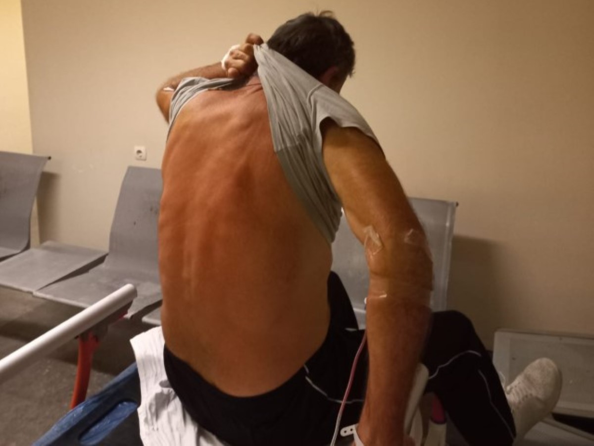 Τρίκαλα: Με γκλοπ ισχυρίζεται ότι δέχθηκε επίθεση ο κ. Παπασίκας