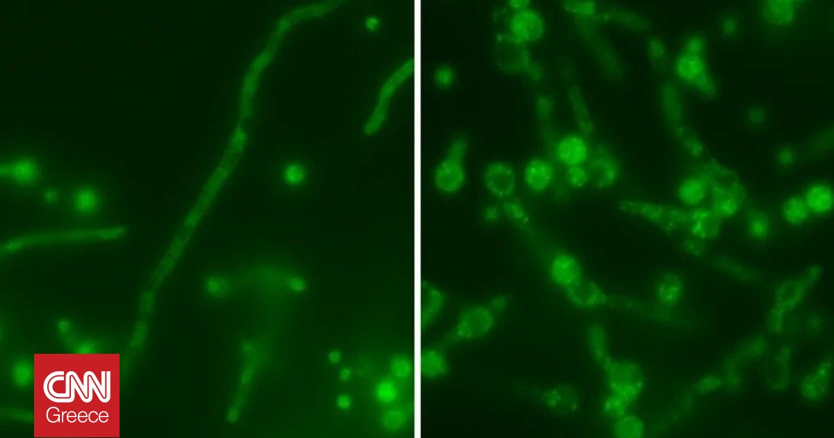 Ιός «μπάμπουσκα» κρύβεται μέσα σε μύκητα, κάνοντάς τον ακόμη πιο επικίνδυνο