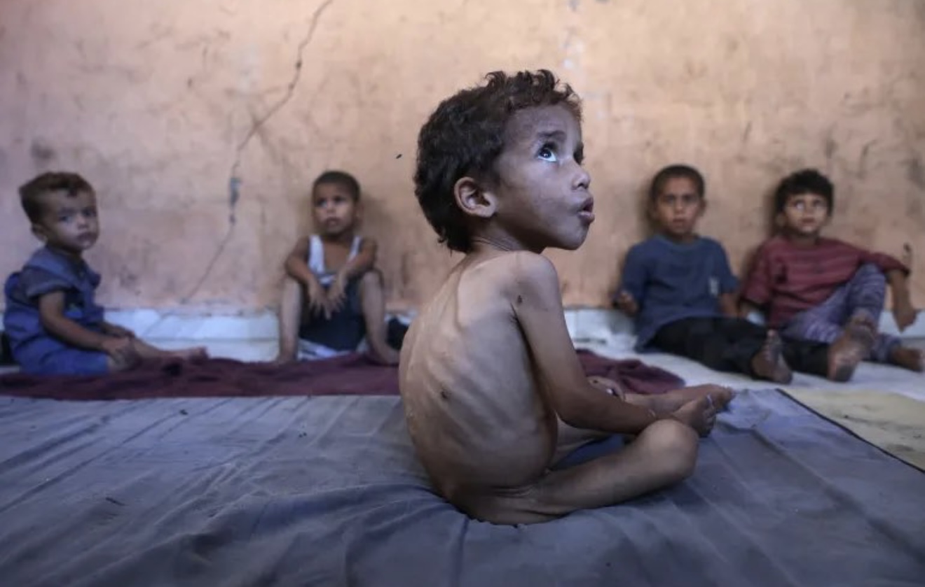 Ο γενικός διευθυντής του ΠΟΥ προειδοποιεί κατά του λιμού στη Λωρίδα της Γάζας 