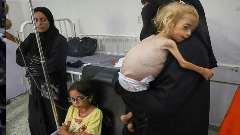 Ιταλία: Κοριτσάκι από τη Γάζα αναρρώνει από υποσιτισμό στην Ιταλία